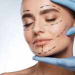 things to consider before and after plastic surgery